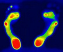 estudio de la marcha